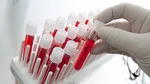 Doktorlara Test Kısıtlaması! Yeni Sağlık Uygulaması Şok Etkisi Yaratı!